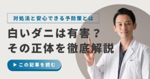 白いダニの正体とは？見つけたときの対処法と安心できる予防策を徹底解説