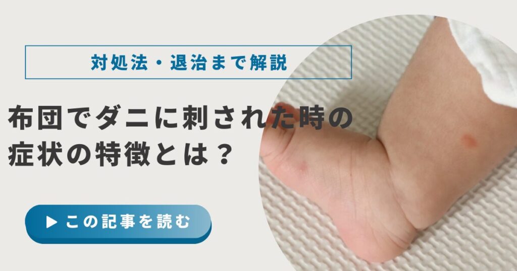 布団でダニに刺された?症状・見分け方・自宅でできる対策を徹底解説