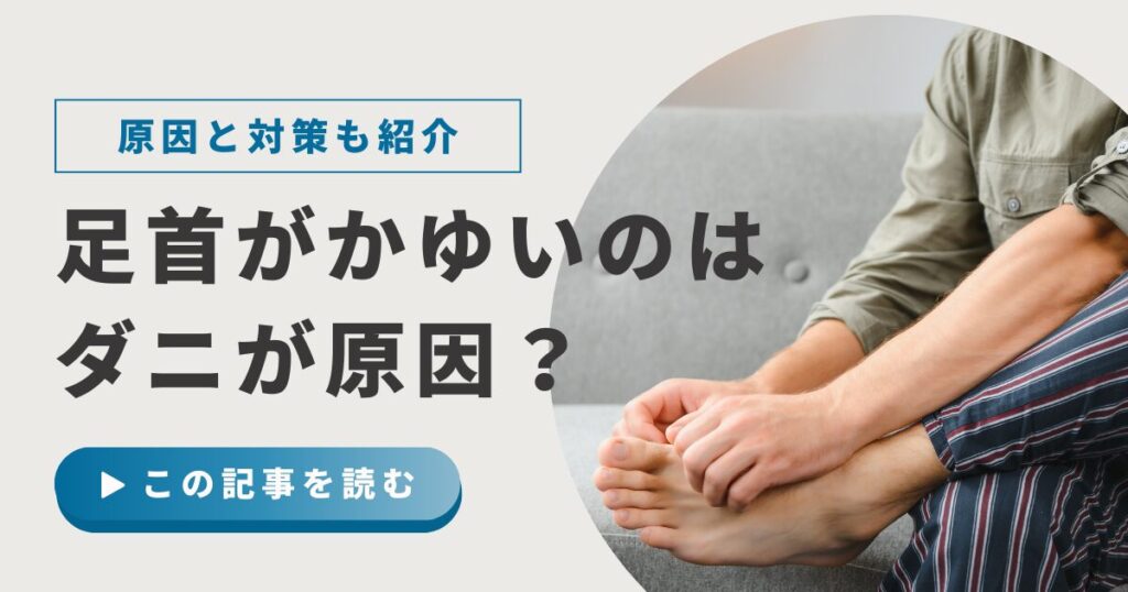 足首のかゆみはダニのせい?乾燥・刺激・虫刺されとの違いと判断目安