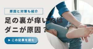 足の裏のかゆみに悩む様子 ダニかどうか確認するポイントを解説