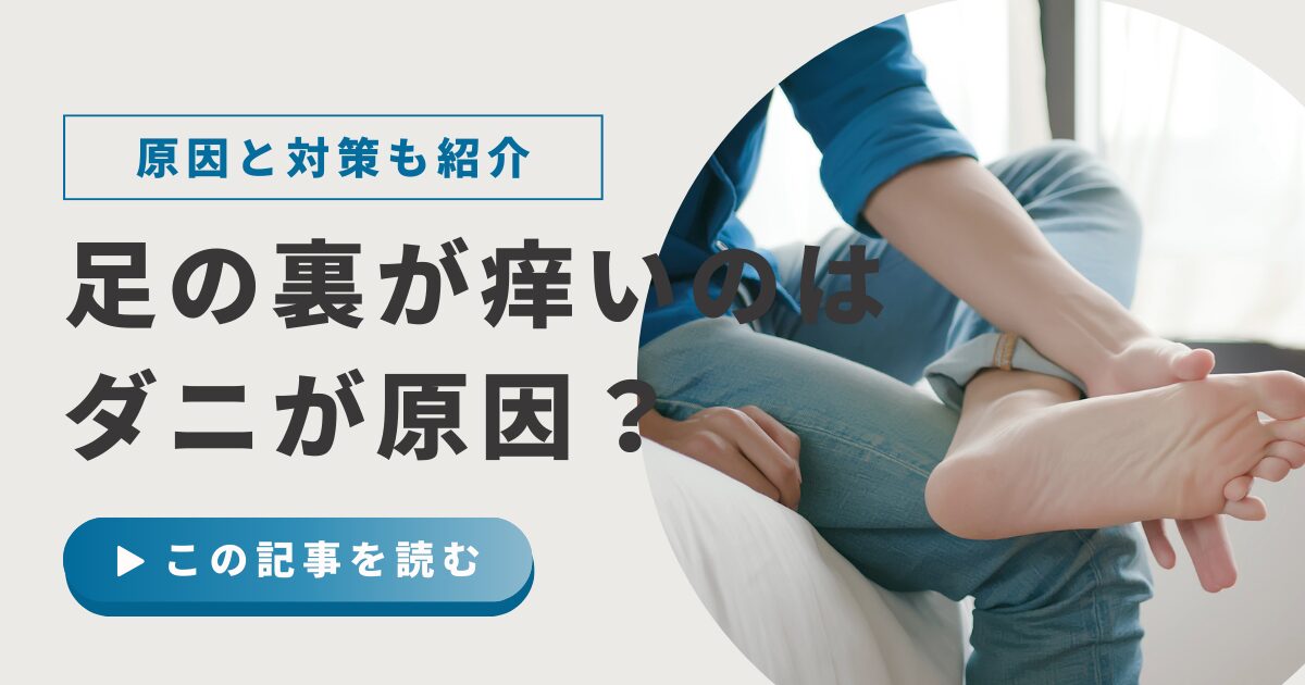 足の裏のかゆみに悩む様子 ダニかどうか確認するポイントを解説