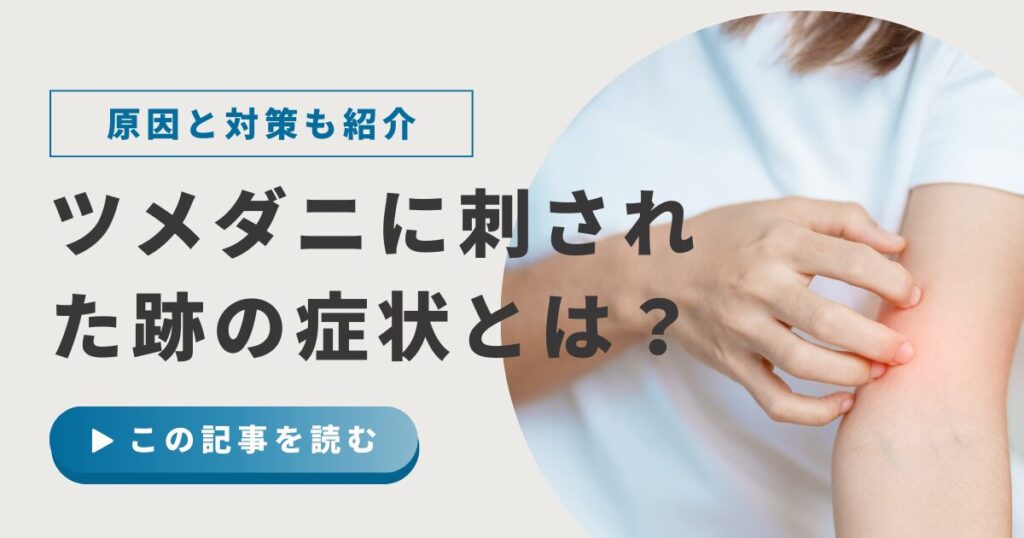 ツメダニに刺された跡の赤い腫れとかゆみの症状