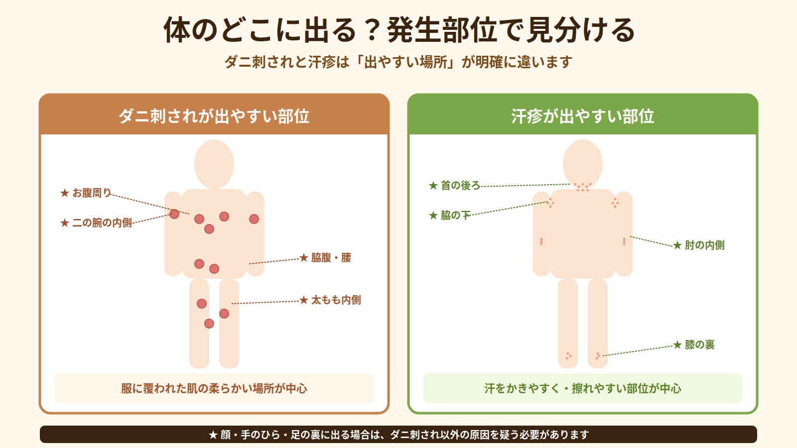 ダニ刺されと汗疹が出やすい部位を人体イラストで示した比較図（ダニ刺され：お腹・腰・太もも内側／汗疹：首・脇・肘膝の内側）