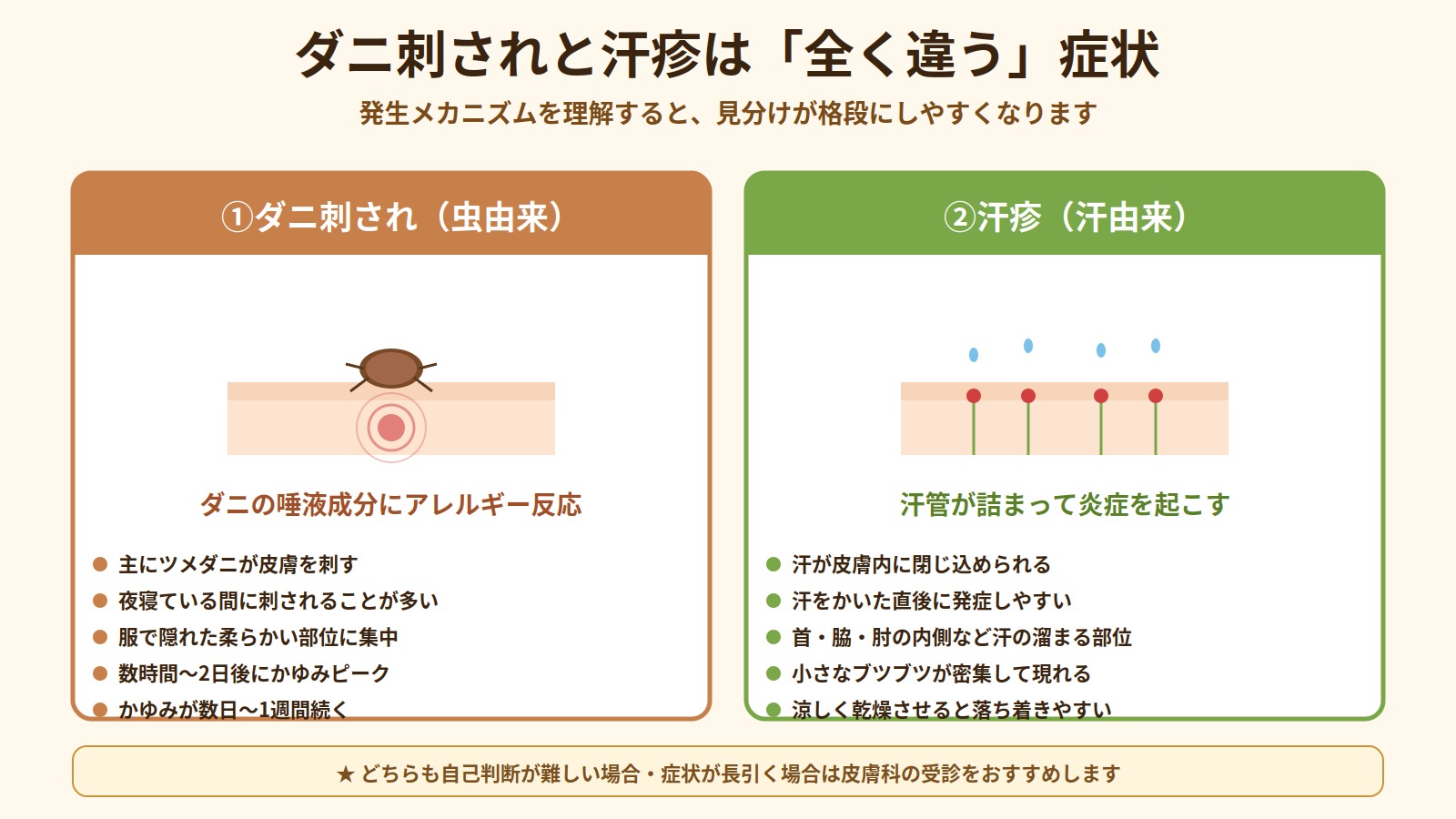 ダニ刺されと汗疹の発生メカニズムの違い（ダニの唾液成分にアレルギー反応 vs 汗管が詰まって炎症）を比較した図解