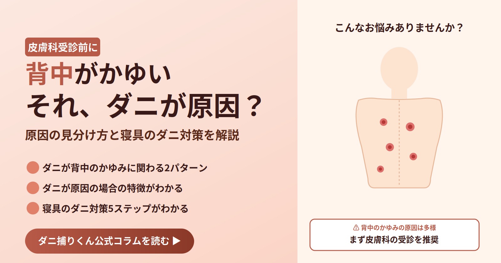 背中がかゆい、それダニが原因？皮膚科受診前に知っておきたい原因の見分け方と寝具のダニ対策を解説するアイキャッチ画像