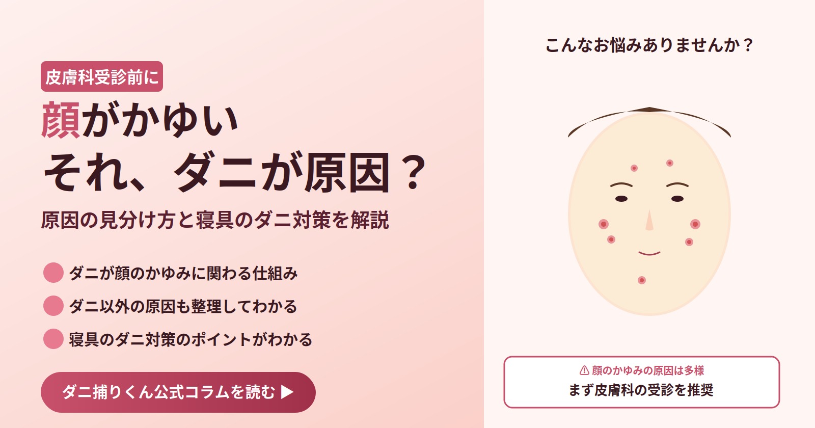 顔がかゆい、それダニが原因？皮膚科受診前に知っておきたい原因の見分け方と寝具のダニ対策を解説するアイキャッチ画像