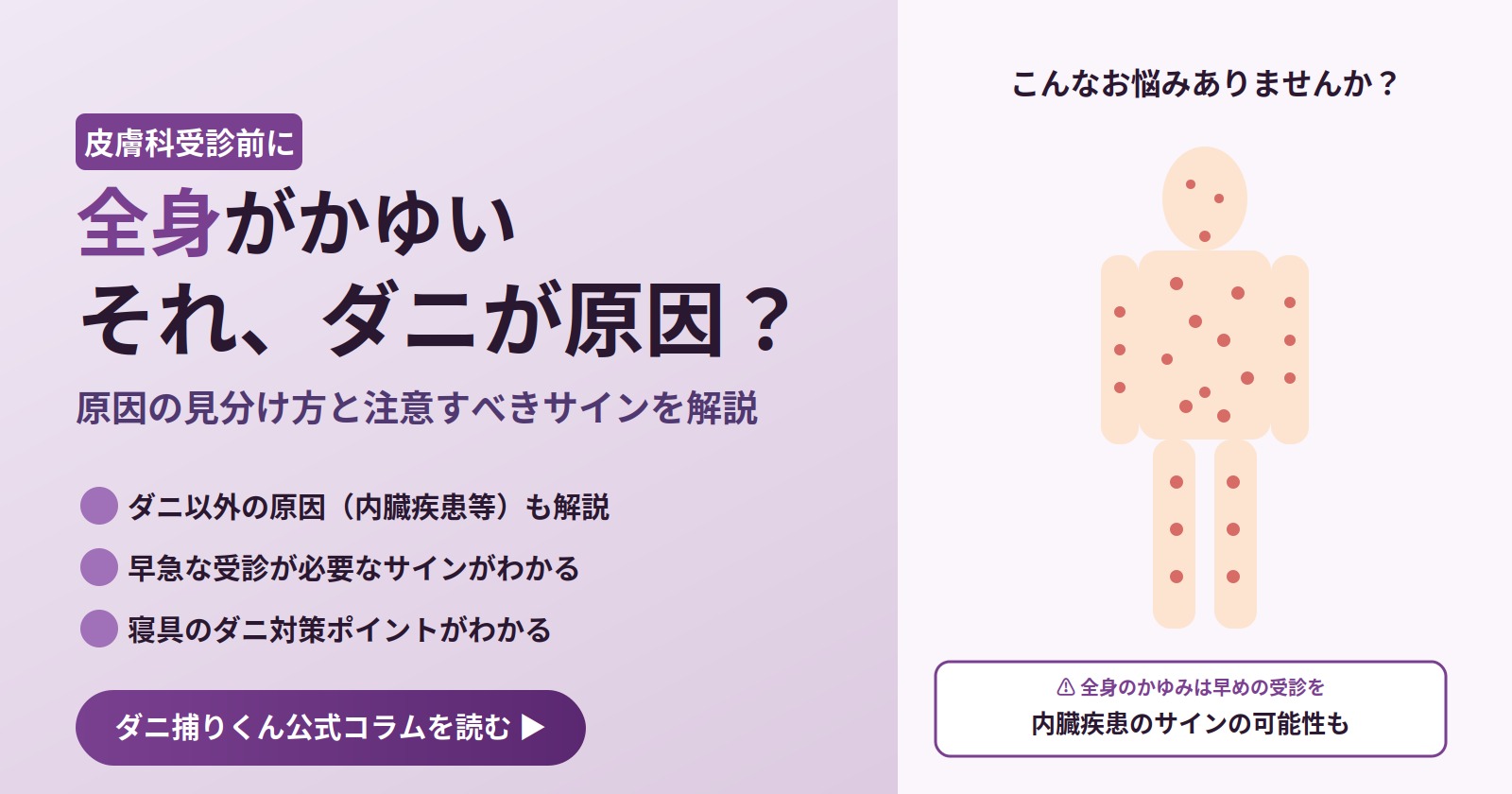 全身がかゆい、それダニが原因?皮膚科受診前に知っておきたい原因の見分け方と注意すべきサインを解説するアイキャッチ画像