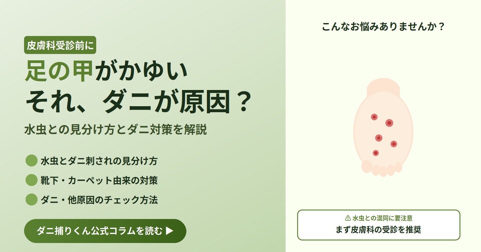 足の甲がかゆい、それダニが原因？皮膚科受診前に知っておきたい水虫との見分け方と寝具のダニ対策を解説するアイキャッチ画像
